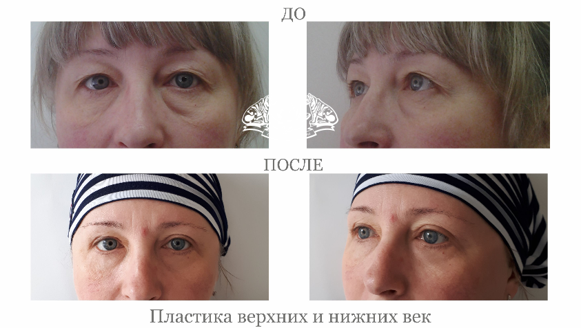 Отзывы о стоматологической клинике До и После на улице 10 лет Октября в Омске - 